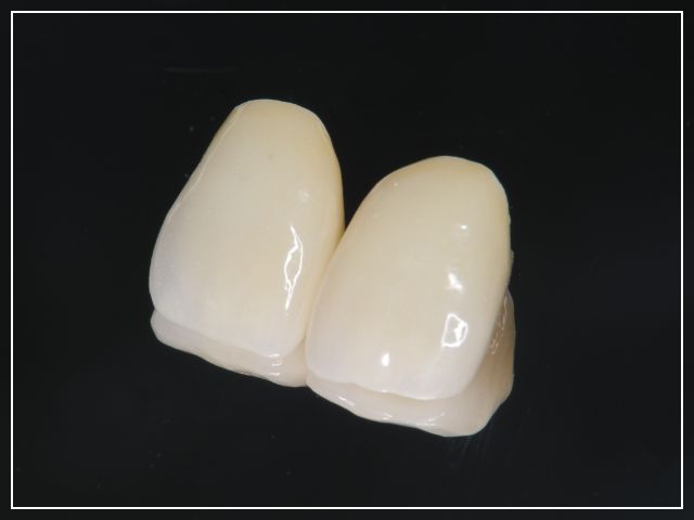審美技工物